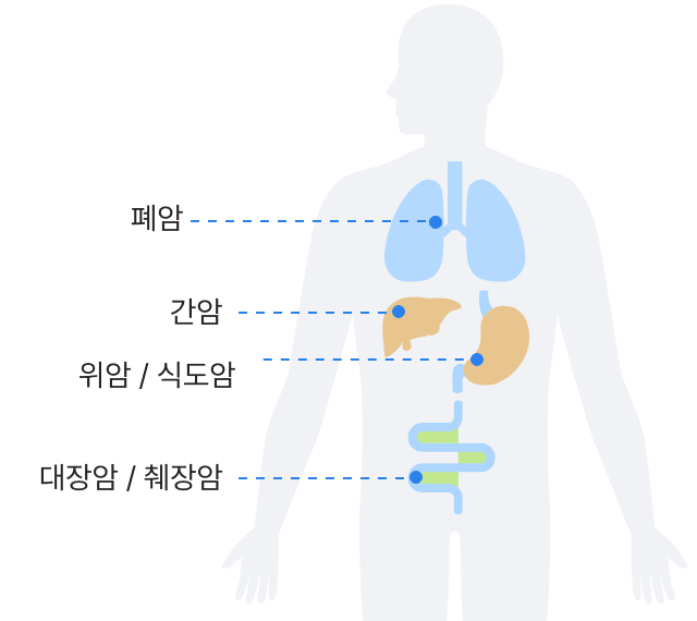 폐암, 간암, 위암/식도암, 대장암/췌장암